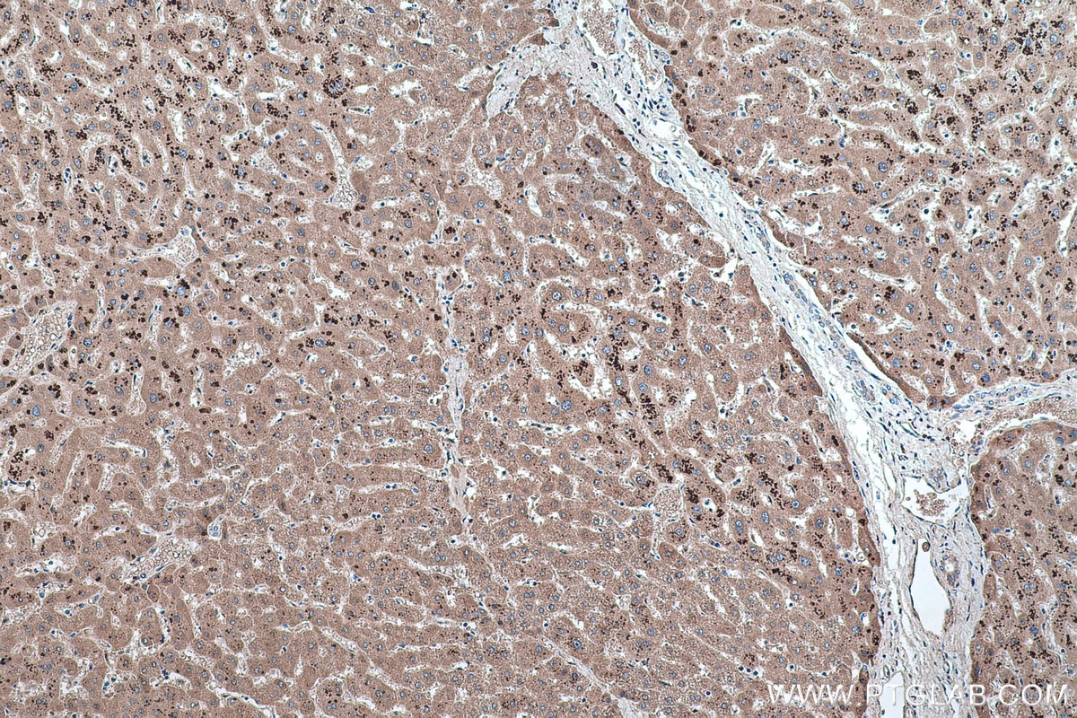 Immunohistochemistry (IHC) staining of human liver tissue using Alpha Sarcoglycan Monoclonal antibody (67078-1-Ig)
