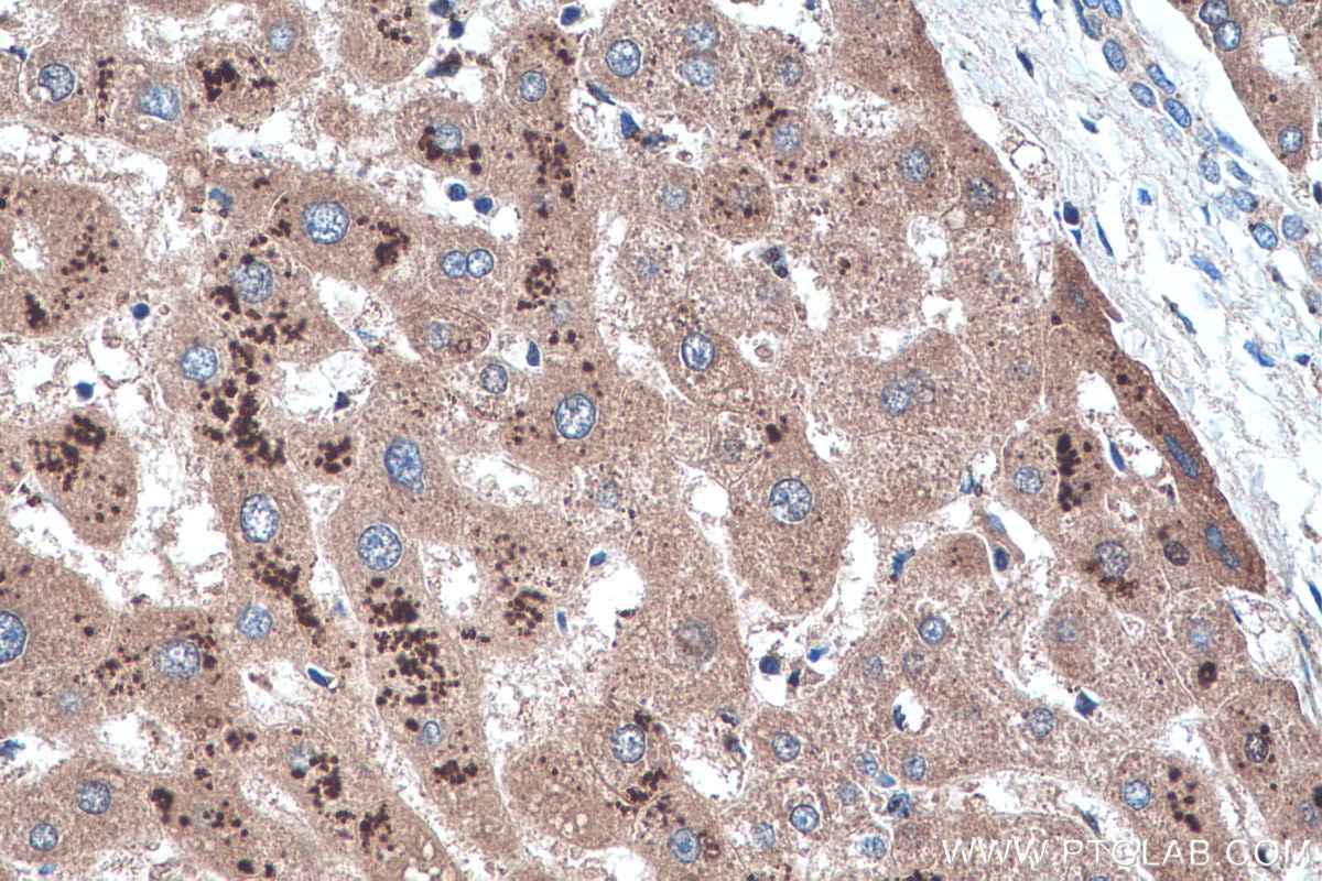 Immunohistochemistry (IHC) staining of human liver tissue using Alpha Sarcoglycan Monoclonal antibody (67078-1-Ig)