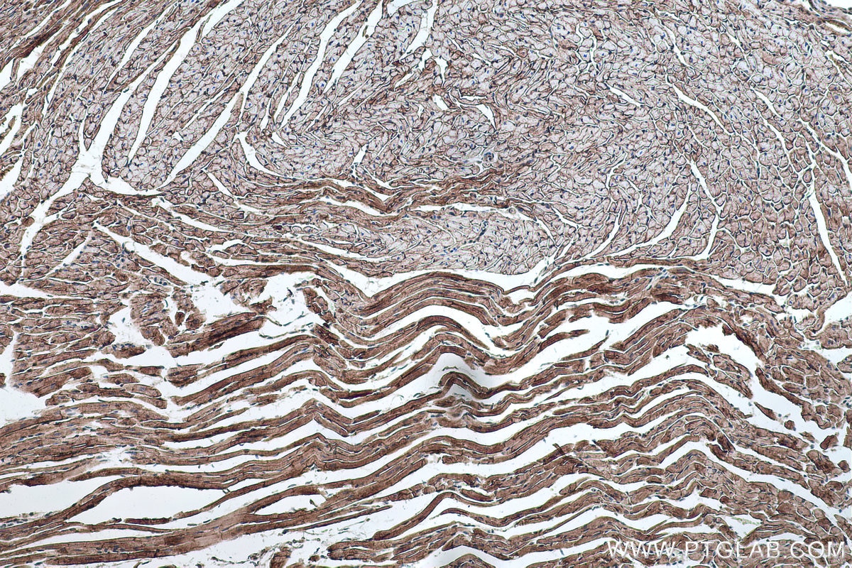 Immunohistochemistry (IHC) staining of mouse heart tissue using Alpha Sarcoglycan Monoclonal antibody (67078-1-Ig)