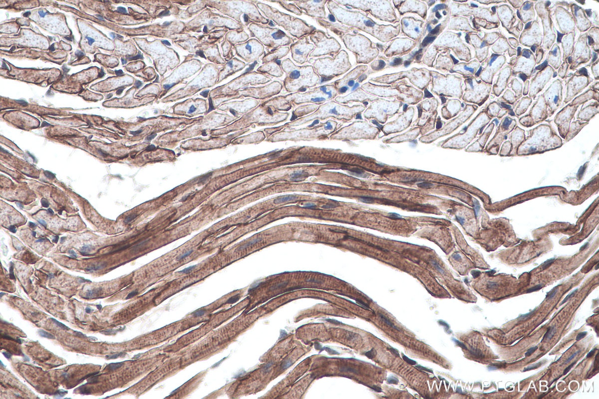Immunohistochemistry (IHC) staining of mouse heart tissue using Alpha Sarcoglycan Monoclonal antibody (67078-1-Ig)