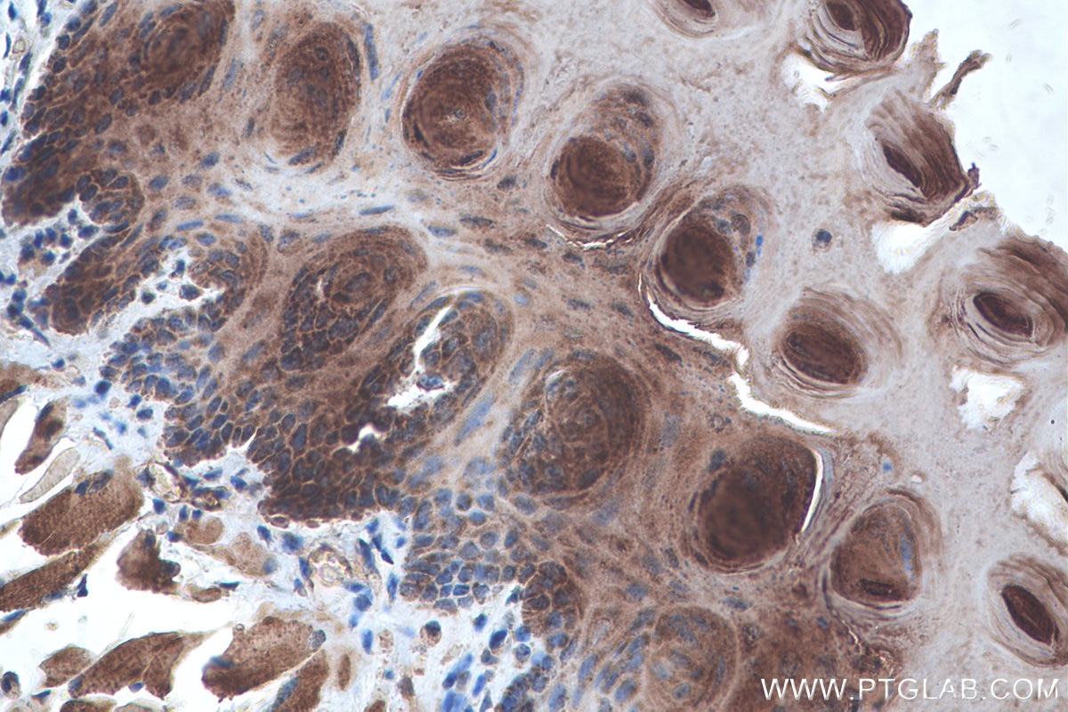 Immunohistochemistry (IHC) staining of mouse tongue tissue using Alpha Sarcoglycan Monoclonal antibody (67078-1-Ig)