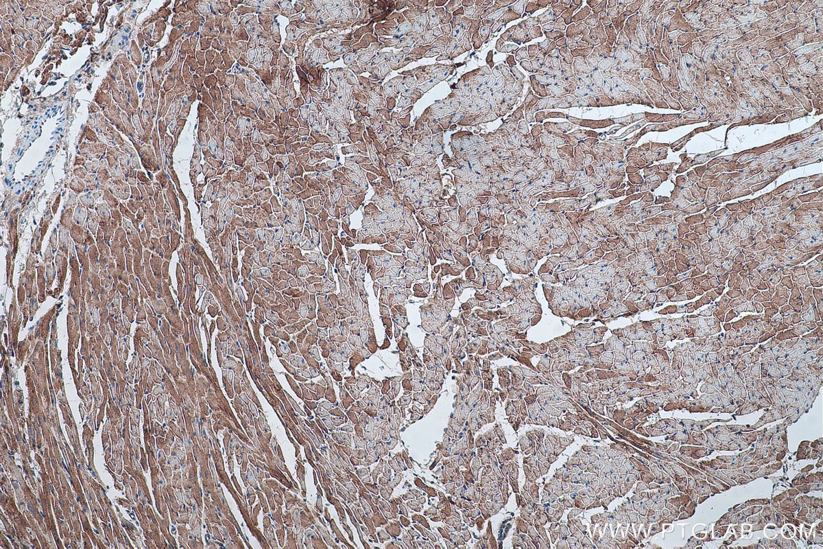 Immunohistochemistry (IHC) staining of rat heart tissue using Alpha Sarcoglycan Monoclonal antibody (67078-1-Ig)