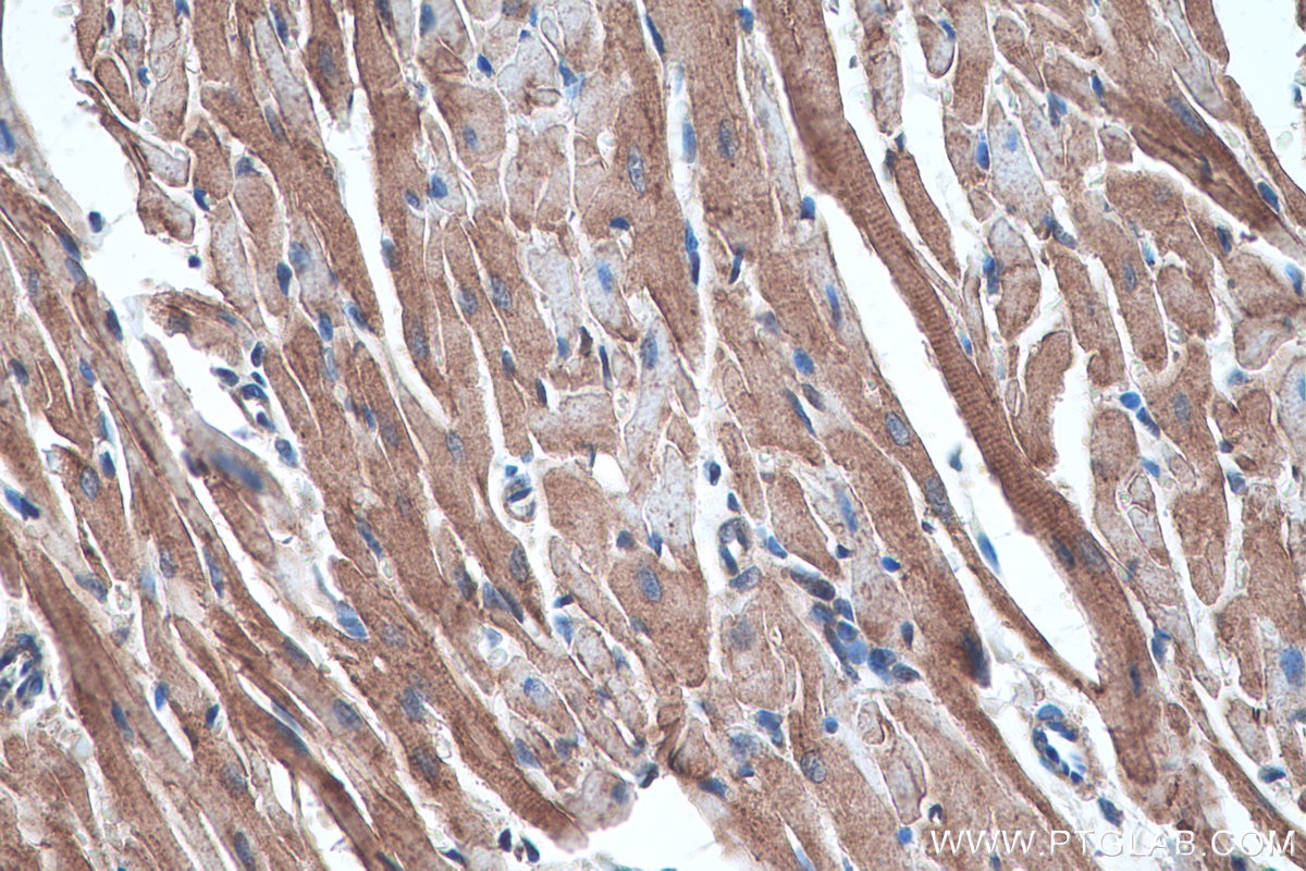 Immunohistochemistry (IHC) staining of rat heart tissue using Alpha Sarcoglycan Monoclonal antibody (67078-1-Ig)