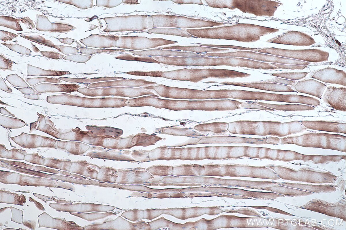 Immunohistochemistry (IHC) staining of rat skeletal muscle tissue using Alpha Sarcoglycan Monoclonal antibody (67078-1-Ig)