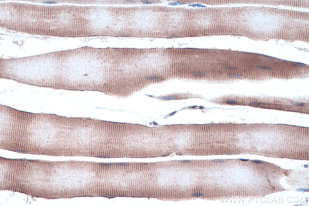 Immunohistochemistry (IHC) staining of rat skeletal muscle tissue using Alpha Sarcoglycan Monoclonal antibody (67078-1-Ig)