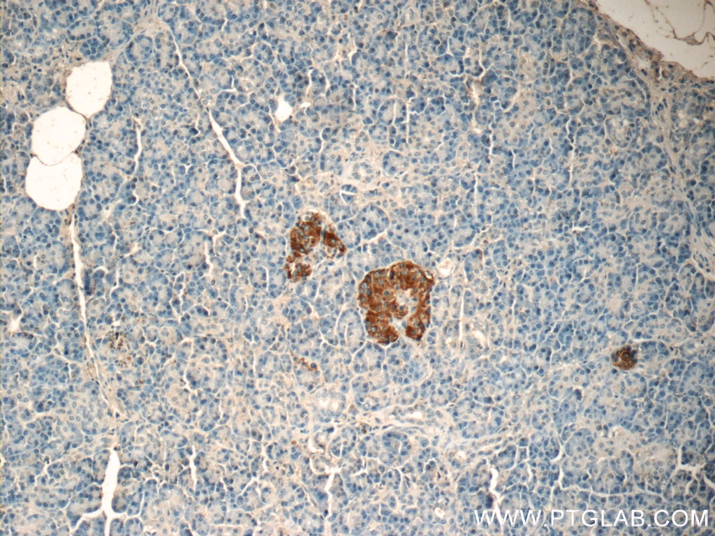 Immunohistochemistry (IHC) staining of human pancreas tissue using Amylin Polyclonal antibody (22305-1-AP)