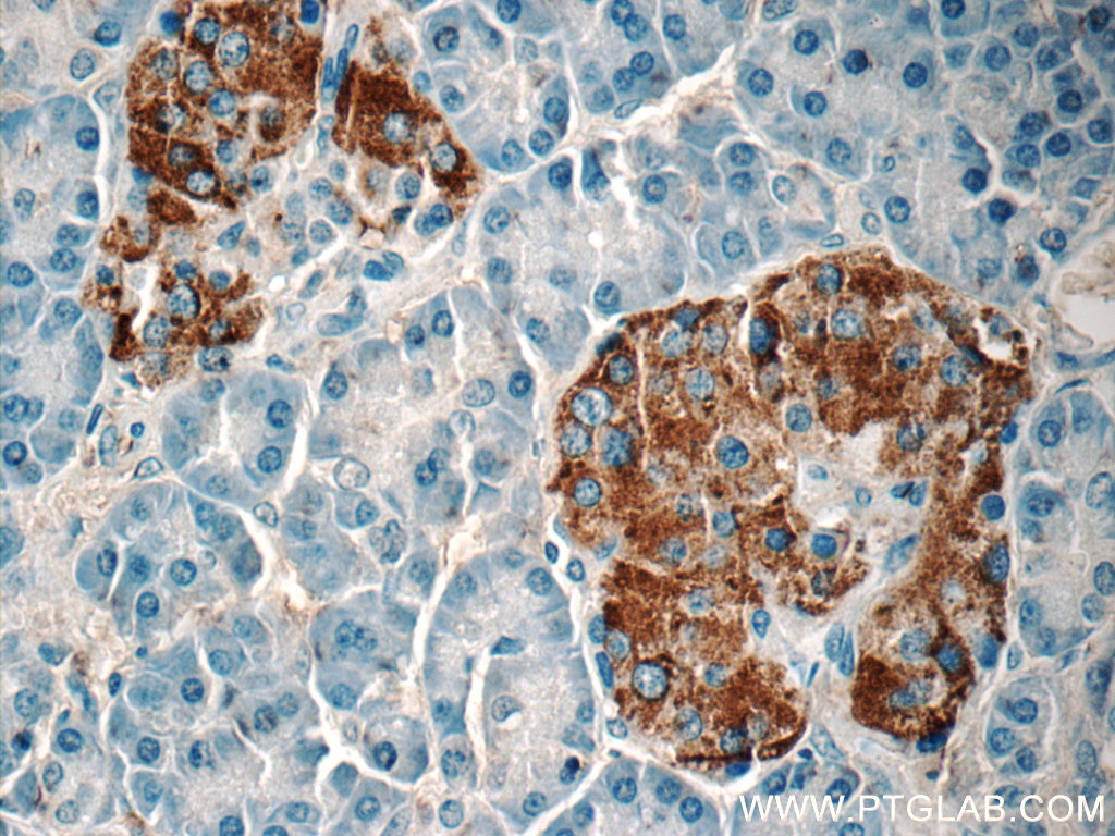 Immunohistochemistry (IHC) staining of human pancreas tissue using Amylin Polyclonal antibody (22305-1-AP)