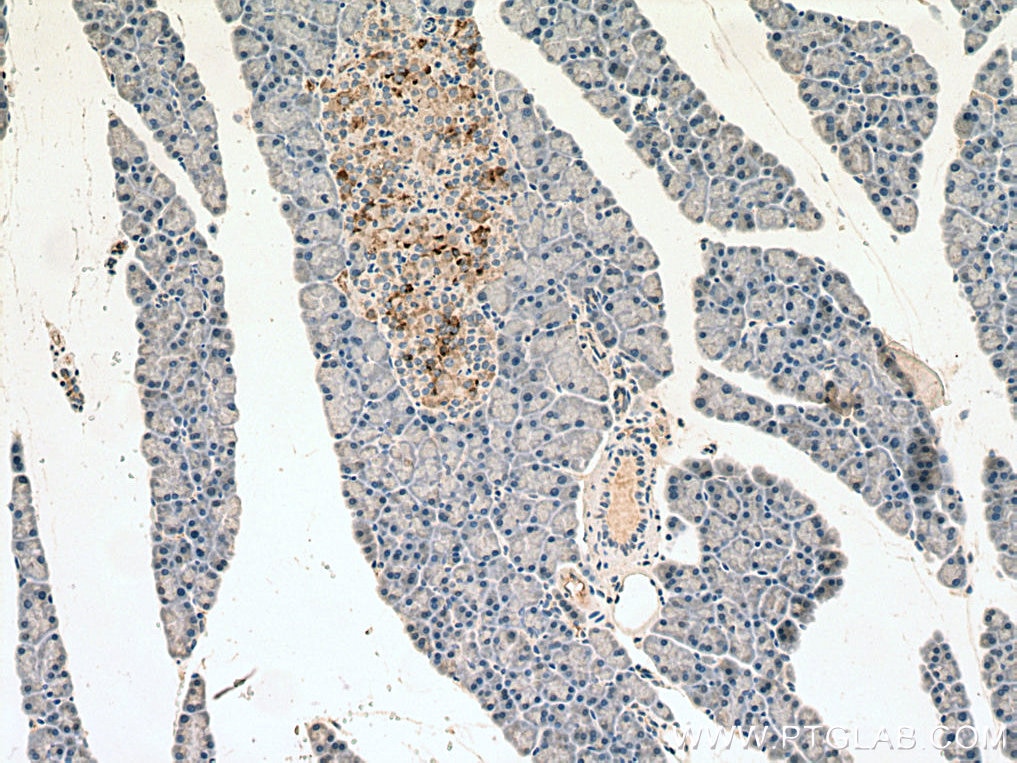 Immunohistochemistry (IHC) staining of rat pancreas tissue using Amylin Polyclonal antibody (22305-1-AP)