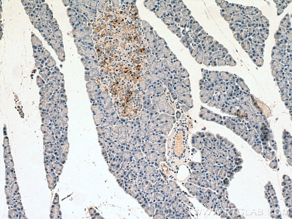 IHC staining of rat pancreas using 22305-1-AP