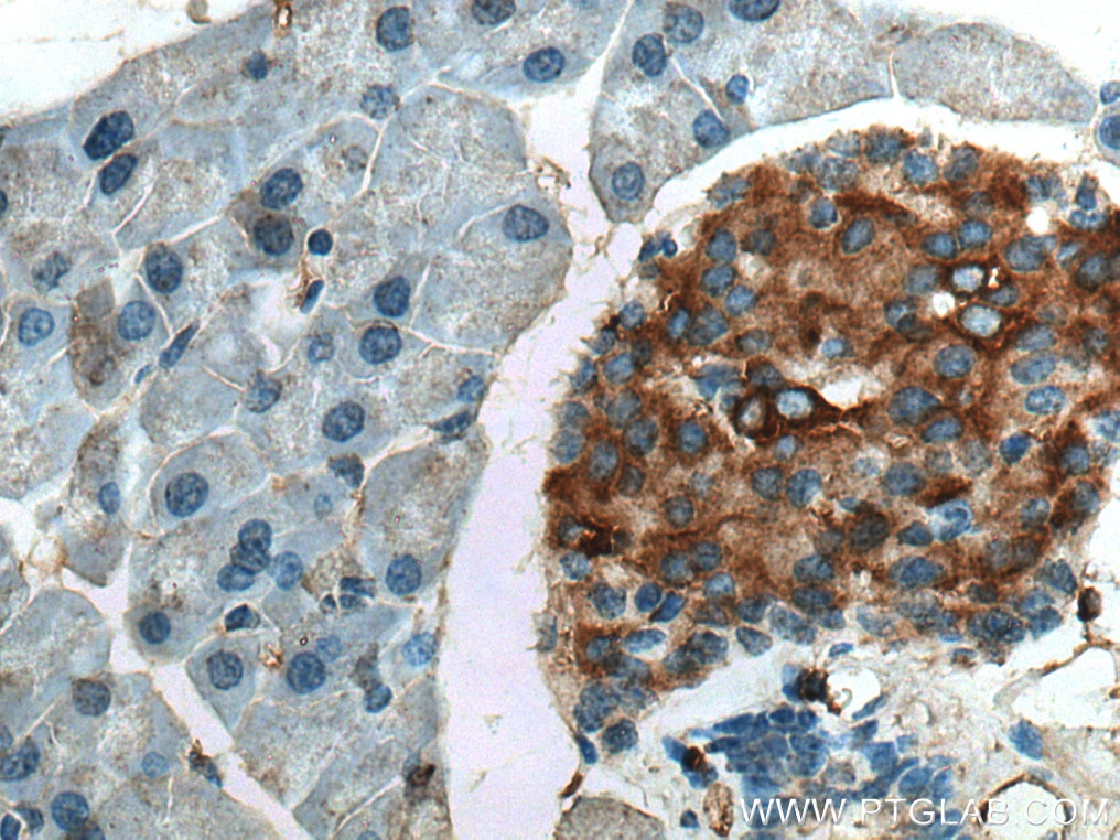 Immunohistochemistry (IHC) staining of mouse pancreas tissue using Amylin Polyclonal antibody (22305-1-AP)