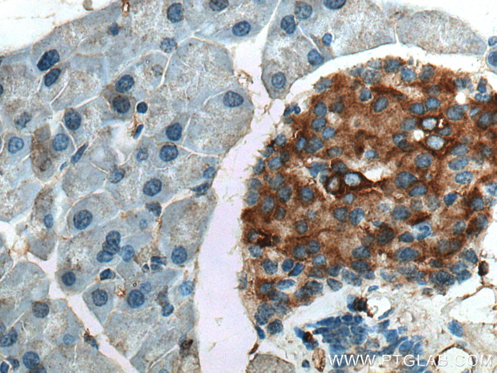 IHC staining of mouse pancreas using 22305-1-AP