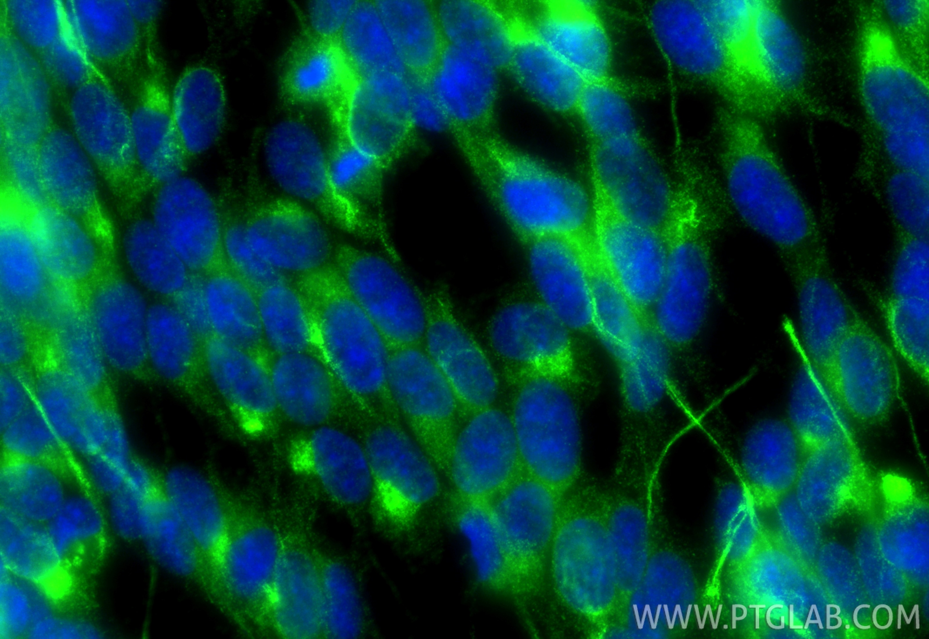 Immunofluorescence (IF) / fluorescent staining of SH-SY5Y cells using APP/Beta Amyloid Polyclonal antibody (25524-1-AP)