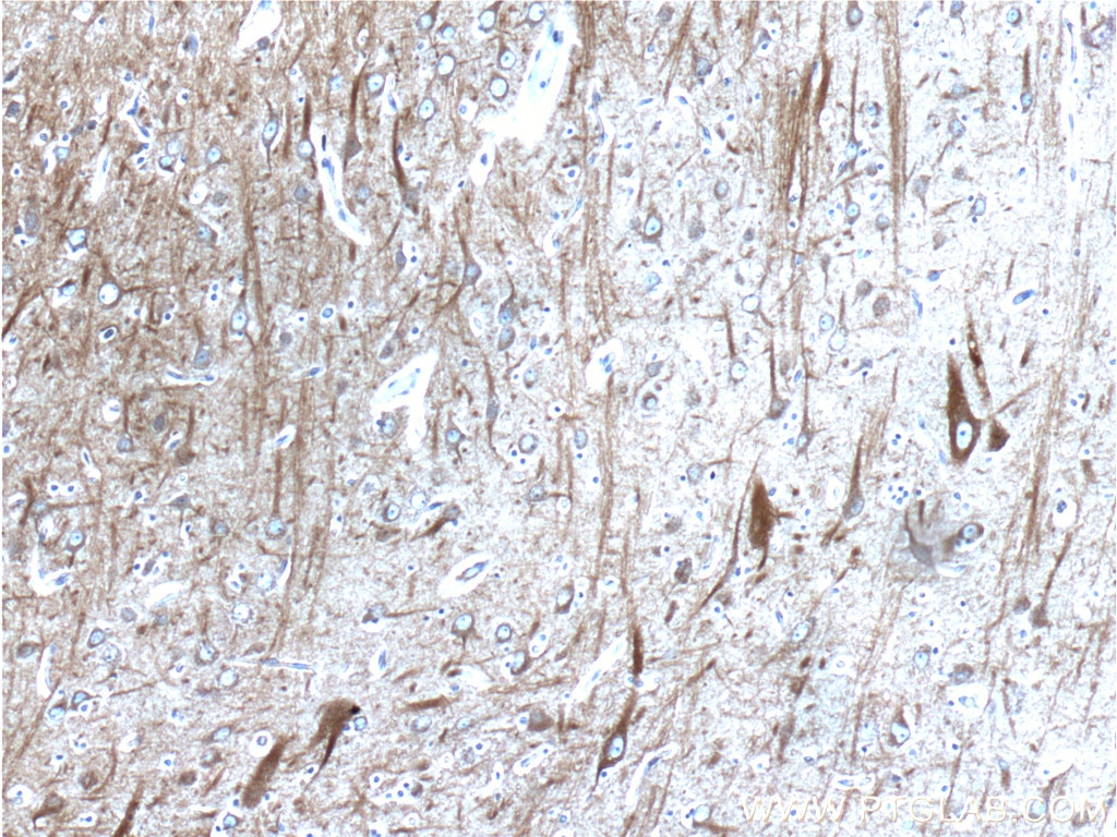 Immunohistochemistry (IHC) staining of human brain tissue using APP/Beta Amyloid Polyclonal antibody (25524-1-AP)