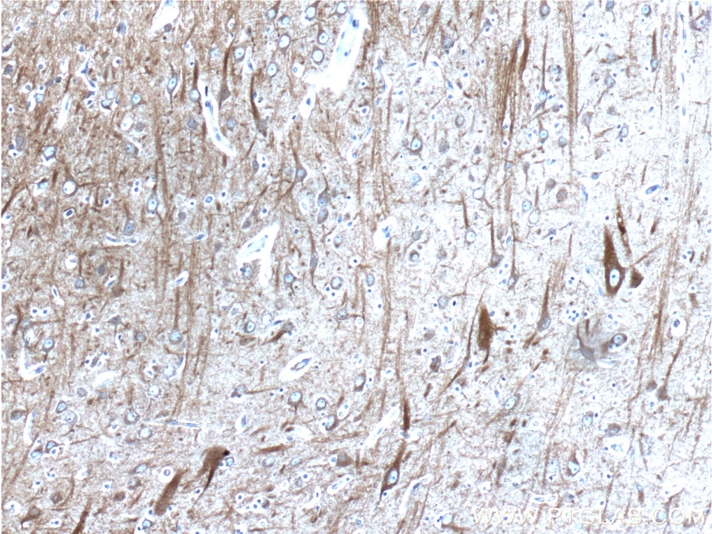 IHC staining of human brain using 25524-1-AP