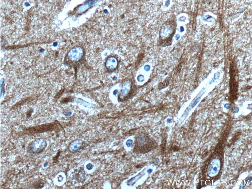 Immunohistochemistry (IHC) staining of human brain tissue using APP/Beta Amyloid Polyclonal antibody (25524-1-AP)