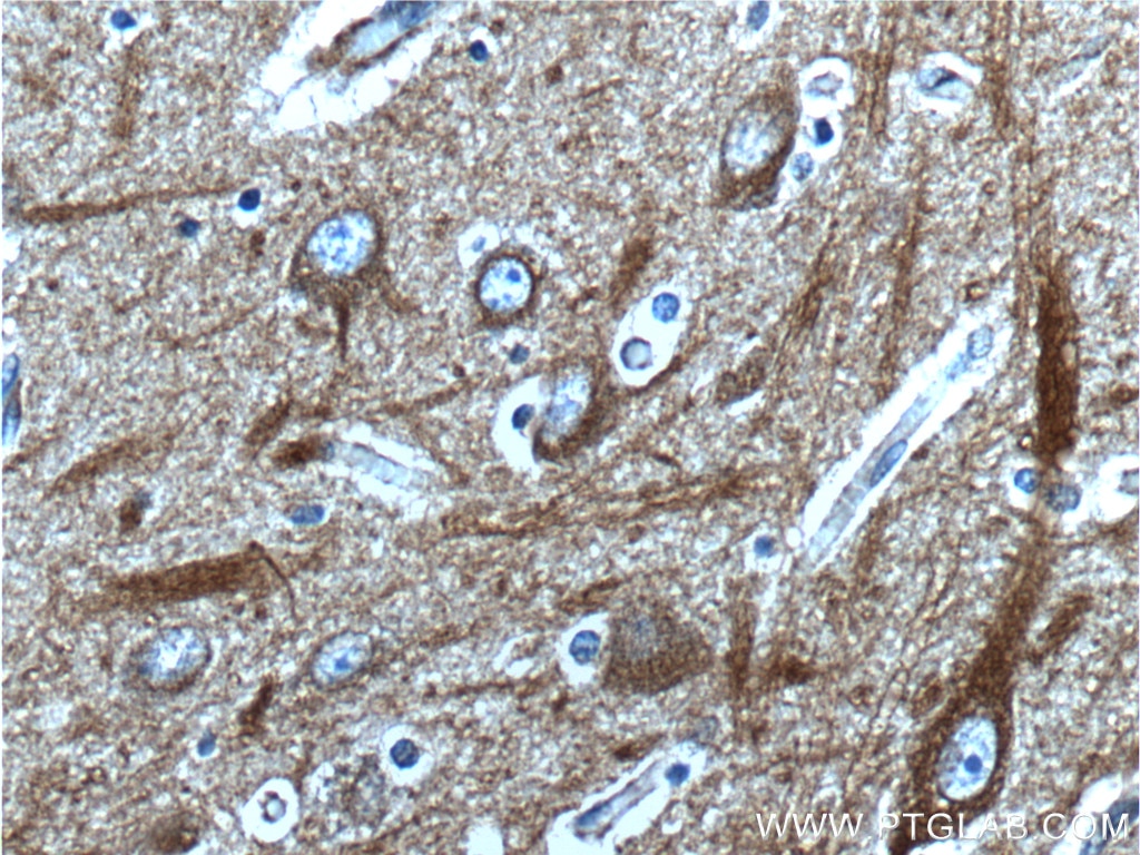 IHC staining of human brain using 25524-1-AP