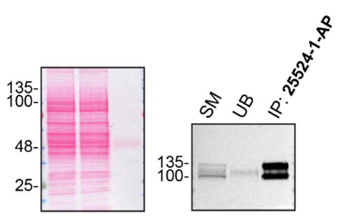 IP experiment of HAP1 using 25524-1-AP