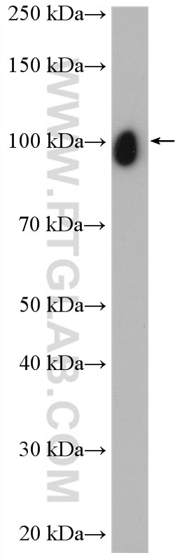 Western Blot (WB) analysis of mouse brain tissue using APP/Beta Amyloid Polyclonal antibody (25524-1-AP)