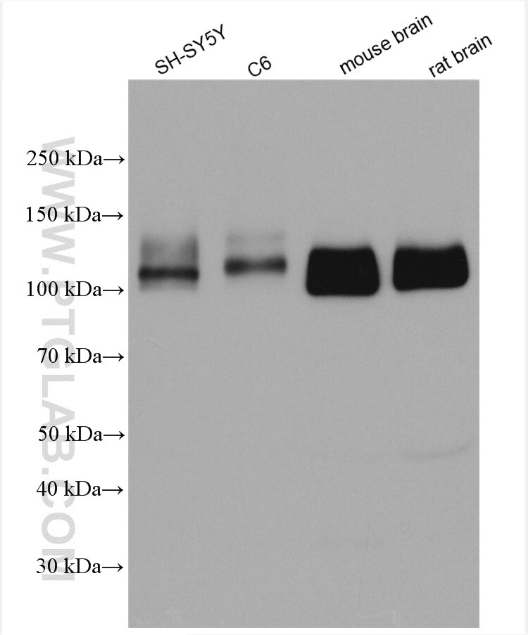 Western Blot (WB) analysis of various lysates using APP/Beta Amyloid Polyclonal antibody (25524-1-AP)