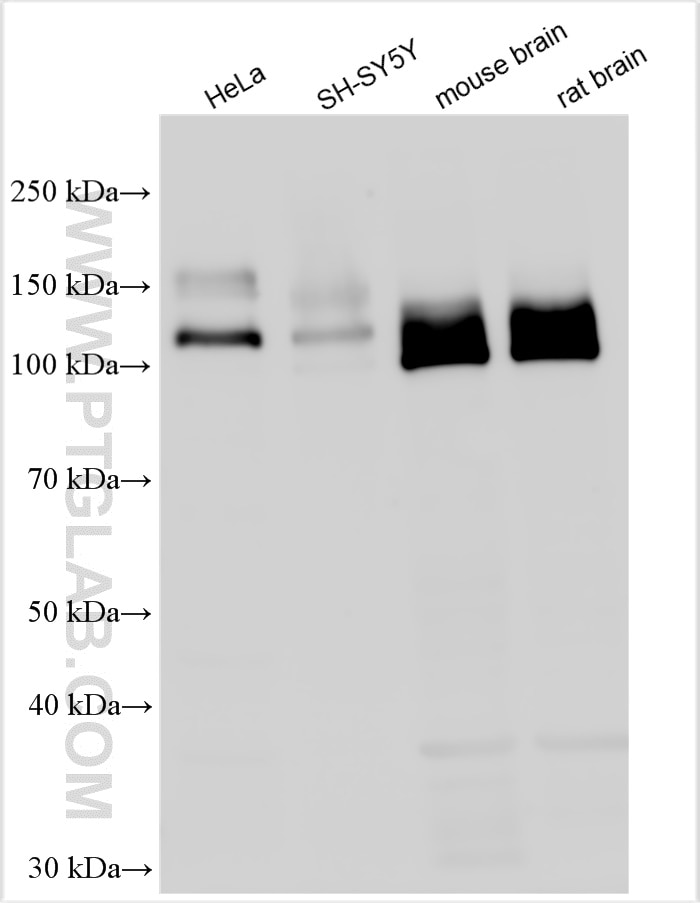 Western Blot (WB) analysis of various lysates using APP/Beta Amyloid Polyclonal antibody (25524-1-AP)