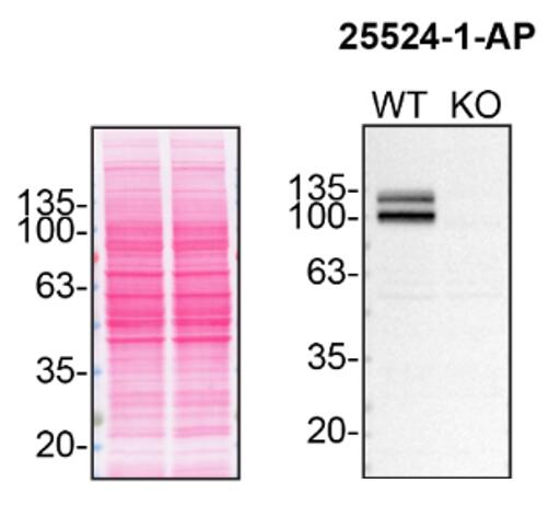 Western Blot (WB) analysis of HAP1 using APP/Beta Amyloid Polyclonal antibody (25524-1-AP)
