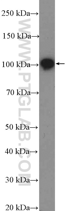 APP/Beta Amyloid Polyclonal antibody