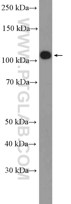 Western Blot (WB) analysis of 3T3-L1 cells using APP/Beta Amyloid Polyclonal antibody (25524-1-AP)