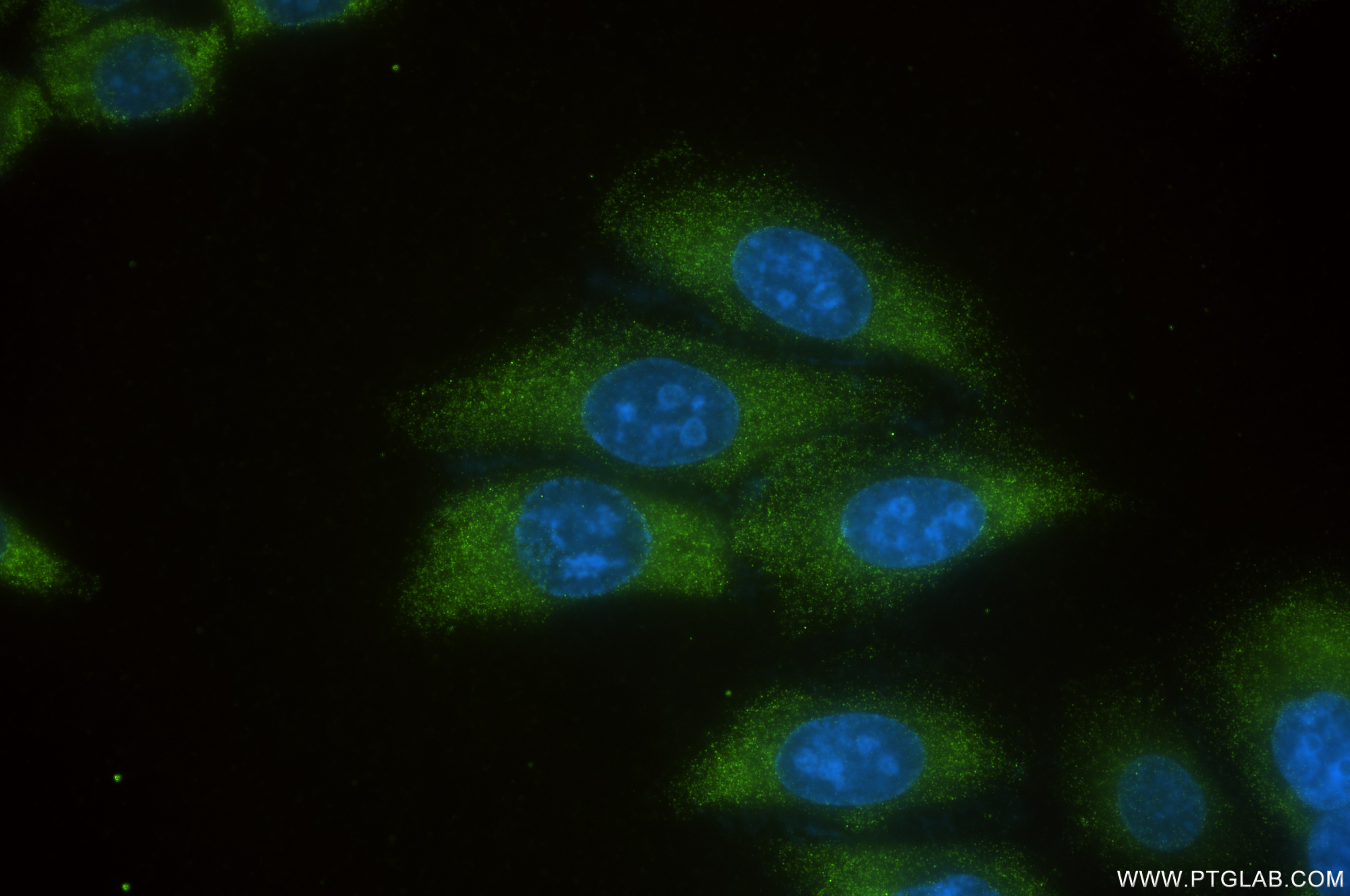 Immunofluorescence (IF) / fluorescent staining of HepG2 cells using Angiogenin Recombinant antibody (85635-1-RR)