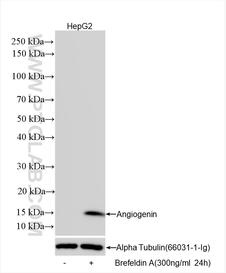 Western Blot (WB) analysis of various lysates using Angiogenin Recombinant antibody (85635-1-RR)