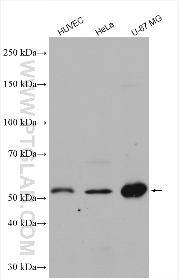 Angiopoietin 1