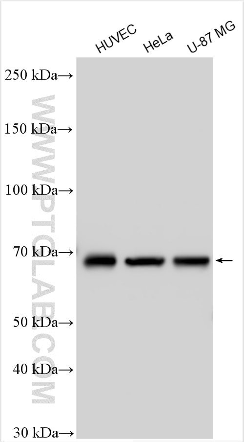 Western Blot (WB) analysis of various lysates using Angiopoietin 1 Polyclonal antibody (27093-1-AP)