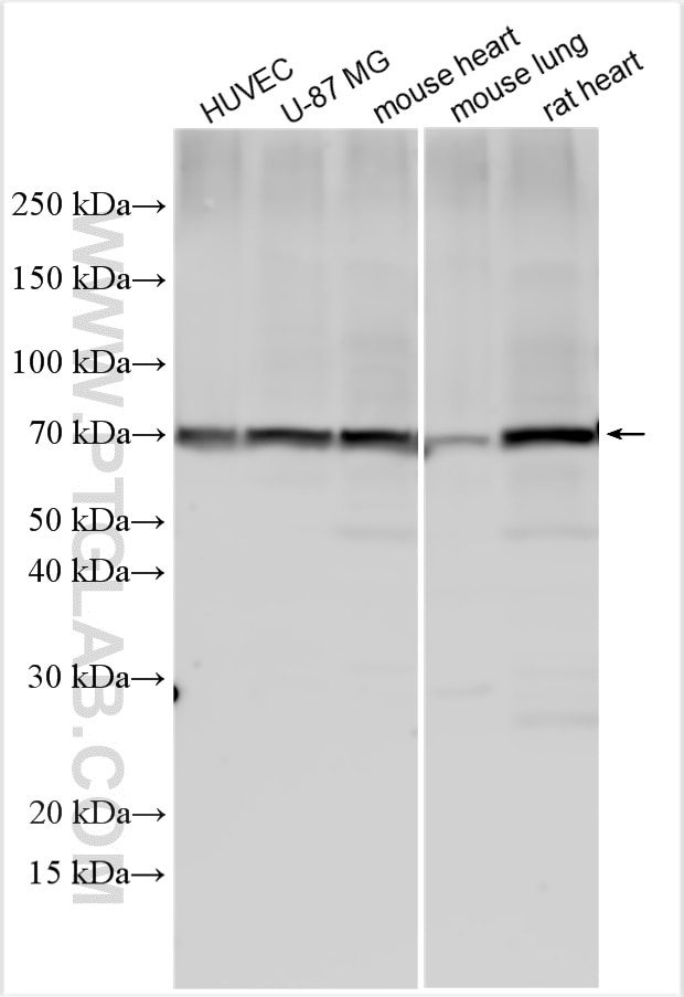 Western Blot (WB) analysis of various lysates using Angiopoietin 1 Polyclonal antibody (27093-1-AP)