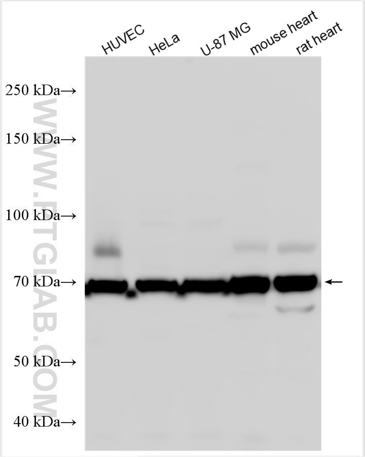 Western Blot (WB) analysis of various lysates using Angiopoietin 1 Polyclonal antibody (27093-1-AP)