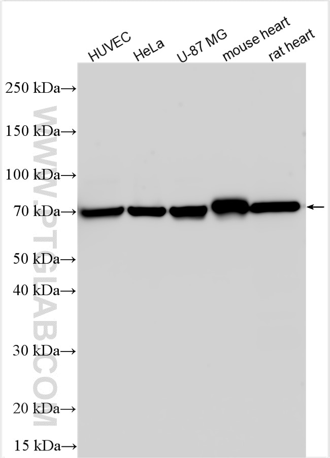 Western Blot (WB) analysis of various lysates using Angiopoietin 1 Polyclonal antibody (27093-1-AP)