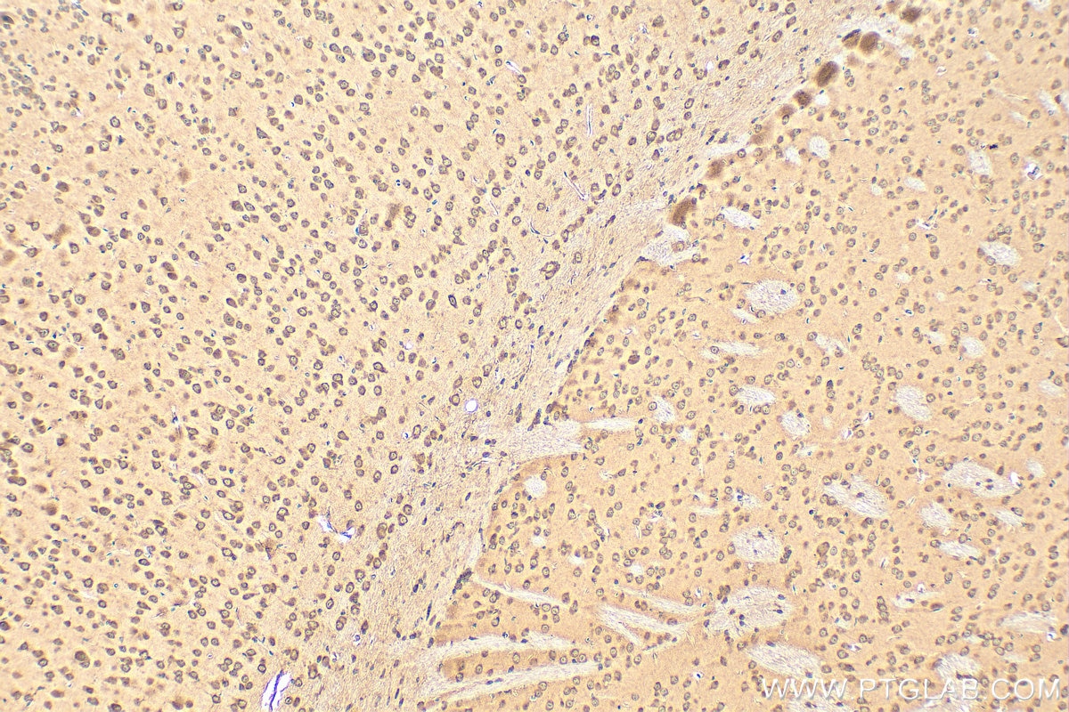 Immunohistochemistry (IHC) staining of mouse brain tissue using Angiopoietin-2 Polyclonal antibody (31499-1-AP)