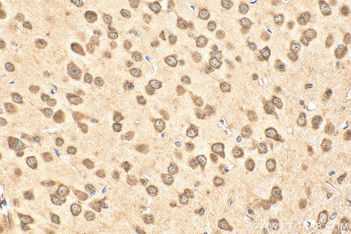 Immunohistochemistry (IHC) staining of mouse brain tissue using Angiopoietin-2 Polyclonal antibody (31499-1-AP)