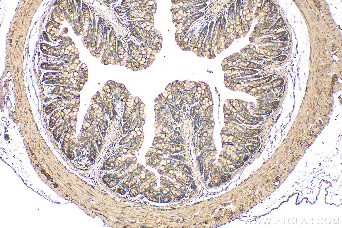 Immunohistochemistry (IHC) staining of mouse colon tissue using Angiopoietin-2 Polyclonal antibody (31499-1-AP)