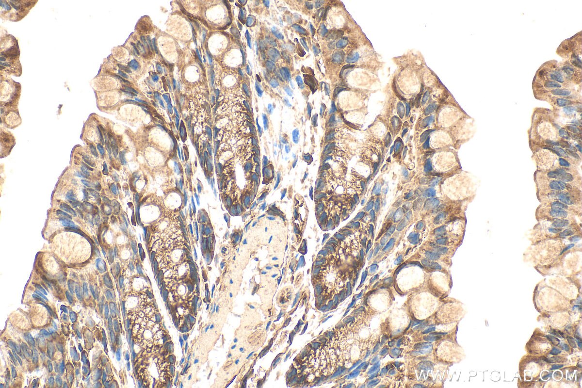 Immunohistochemistry (IHC) staining of mouse colon tissue using Angiopoietin-2 Polyclonal antibody (31499-1-AP)