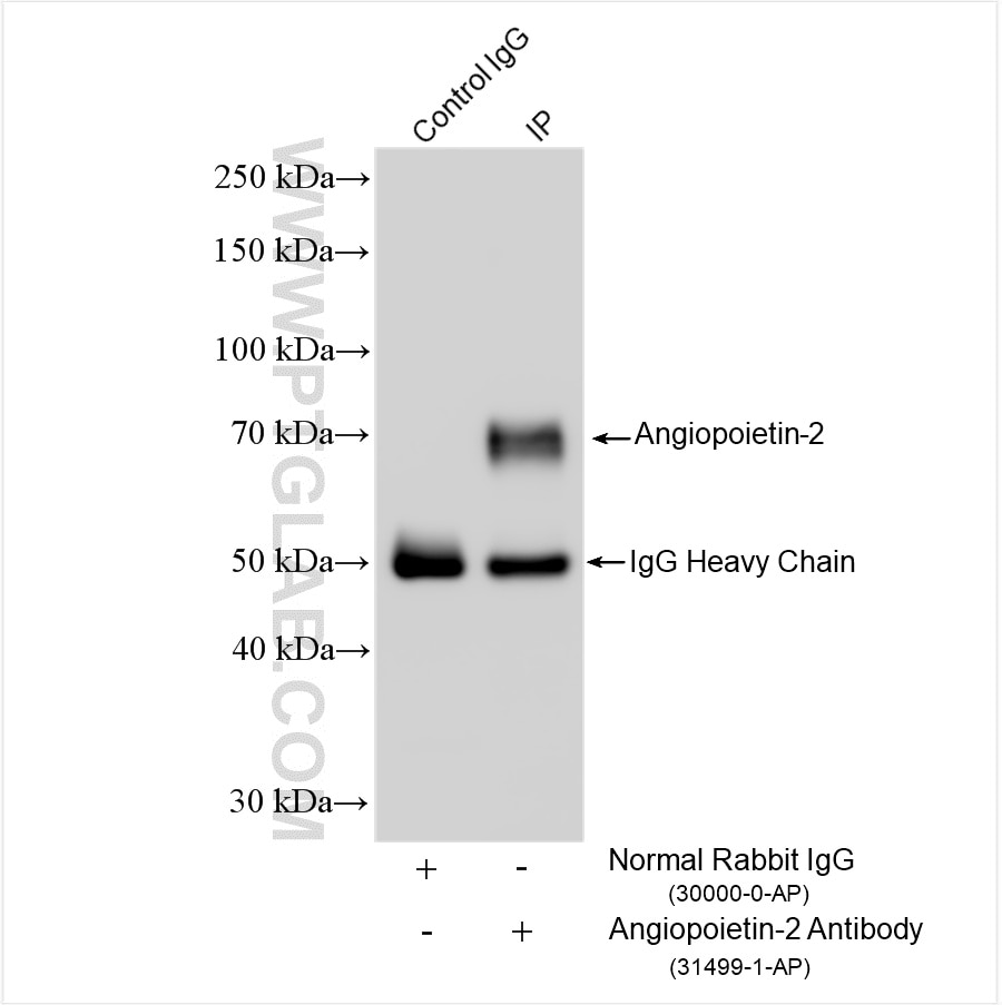 Immunoprecipitation (IP) experiment of rat lung tissue using Angiopoietin-2 Polyclonal antibody (31499-1-AP)