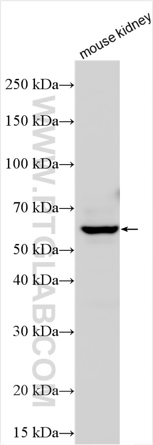 Western Blot (WB) analysis of various lysates using Angiopoietin-2 Polyclonal antibody (31499-1-AP)