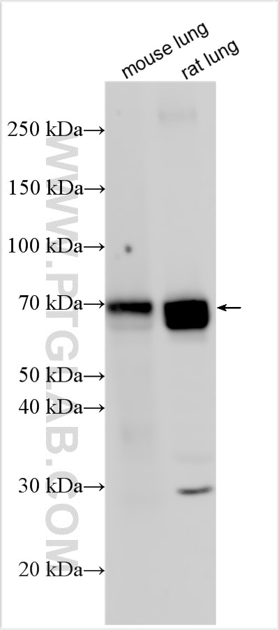 Western Blot (WB) analysis of various lysates using Angiopoietin-2 Polyclonal antibody (31499-1-AP)