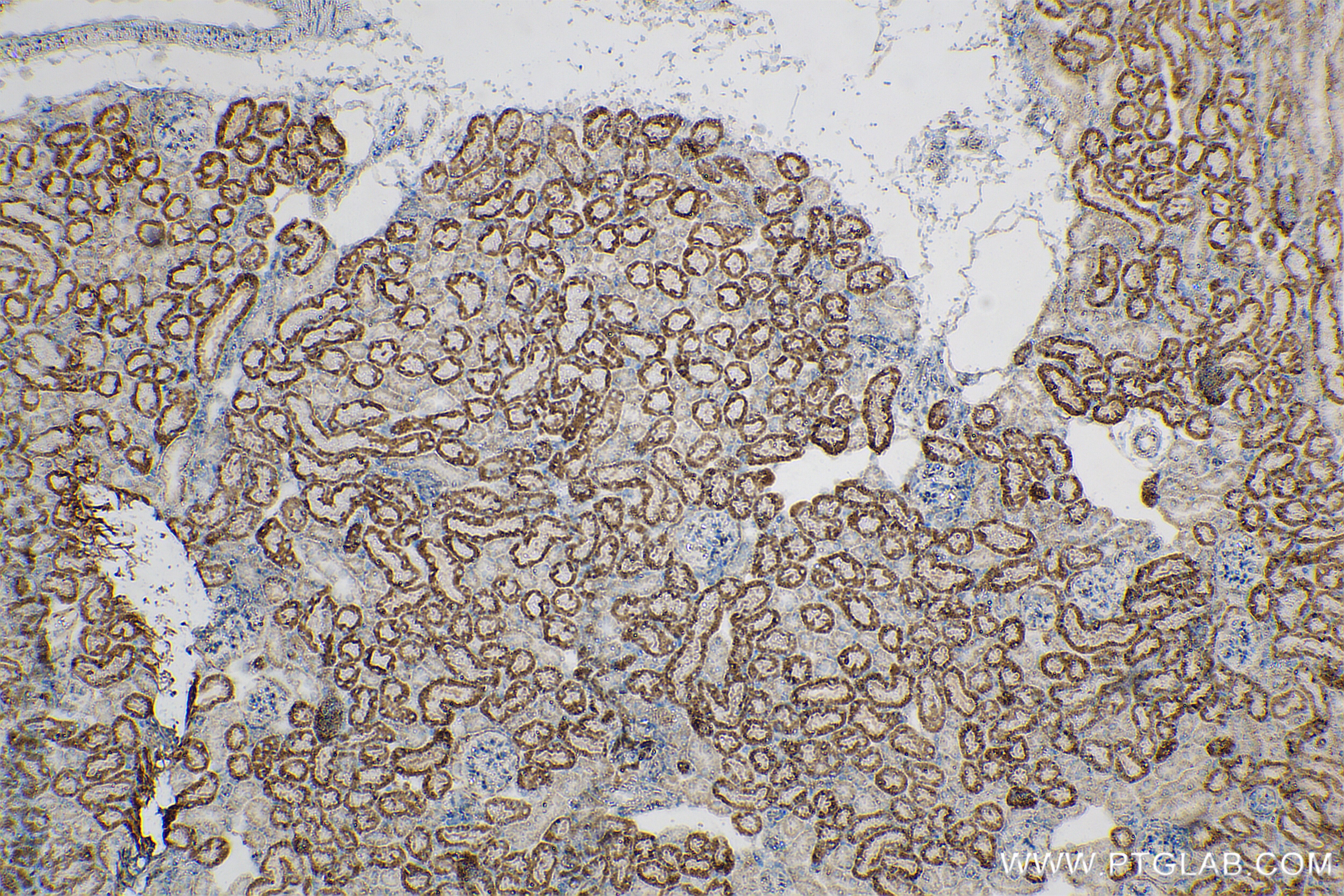 Immunohistochemistry (IHC) staining of mouse kidney tissue using Angiopoietin-2 Recombinant antibody (83816-1-RR)