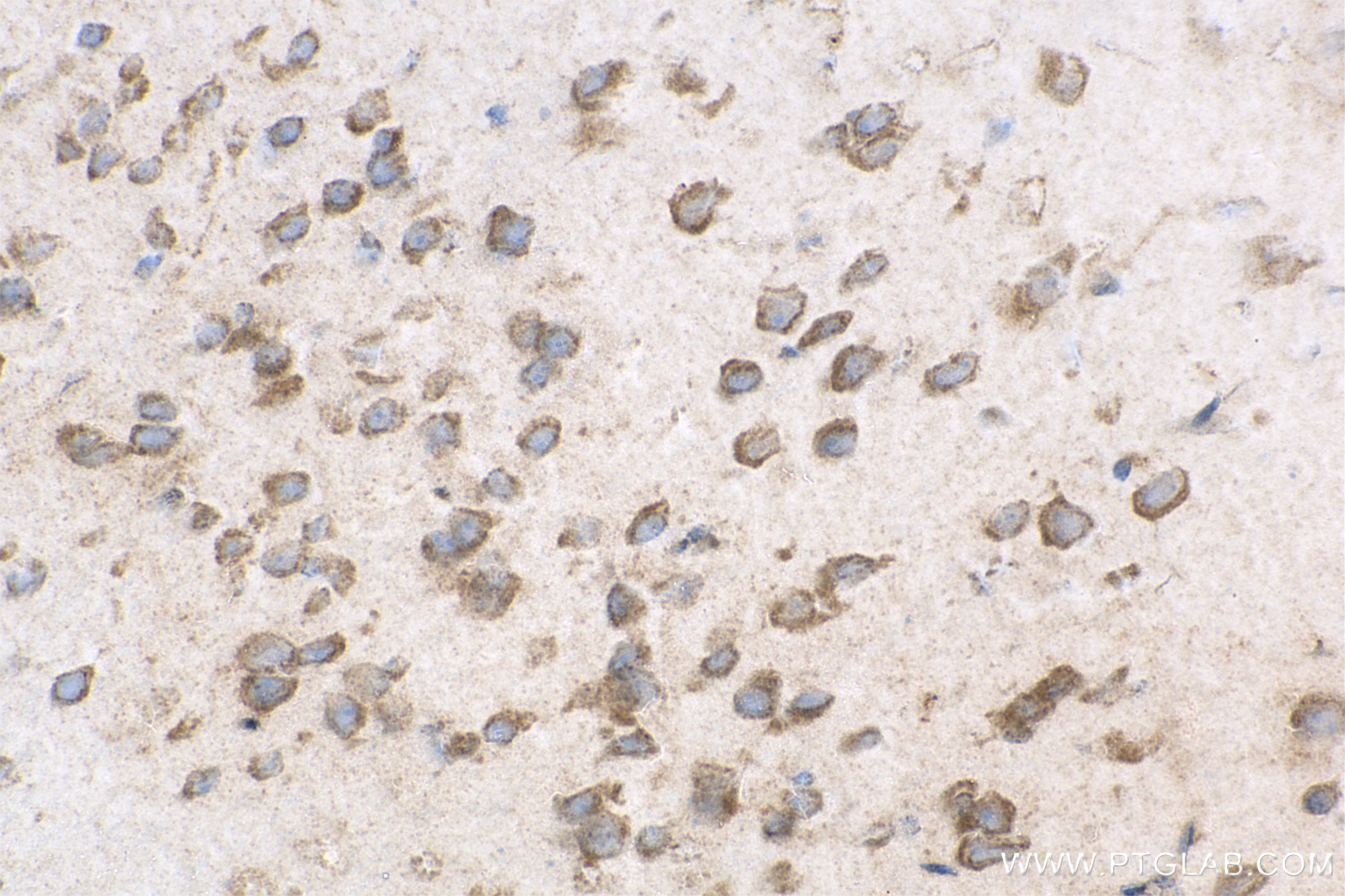 Immunohistochemistry (IHC) staining of mouse brain tissue using Angiopoietin-2 Recombinant antibody (83816-1-RR)