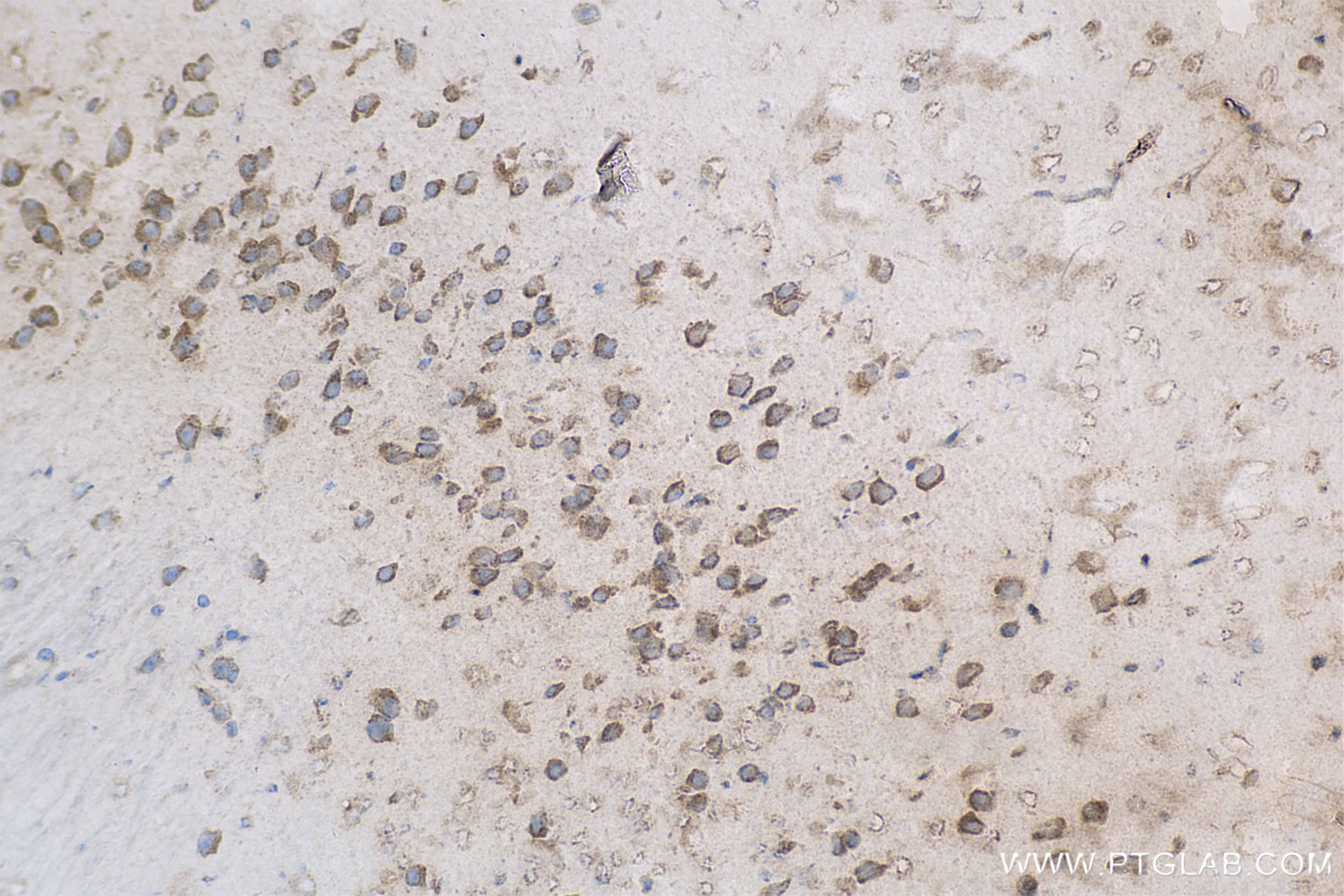 Immunohistochemistry (IHC) staining of mouse brain tissue using Angiopoietin-2 Recombinant antibody (83816-1-RR)