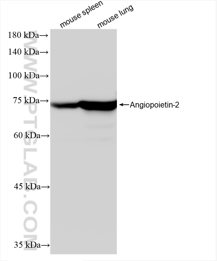 Western Blot (WB) analysis of various lysates using Angiopoietin-2 Recombinant antibody (83816-1-RR)