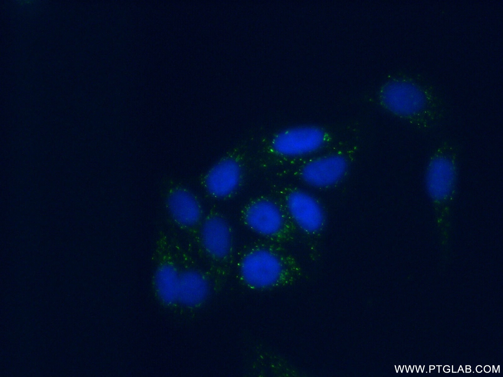Immunofluorescence (IF) / fluorescent staining of HepG2 cells using Plasminogen Polyclonal antibody (18300-1-AP)