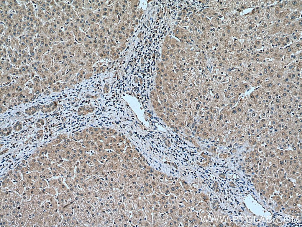 Immunohistochemistry (IHC) staining of human liver tissue using Plasminogen Polyclonal antibody (18300-1-AP)