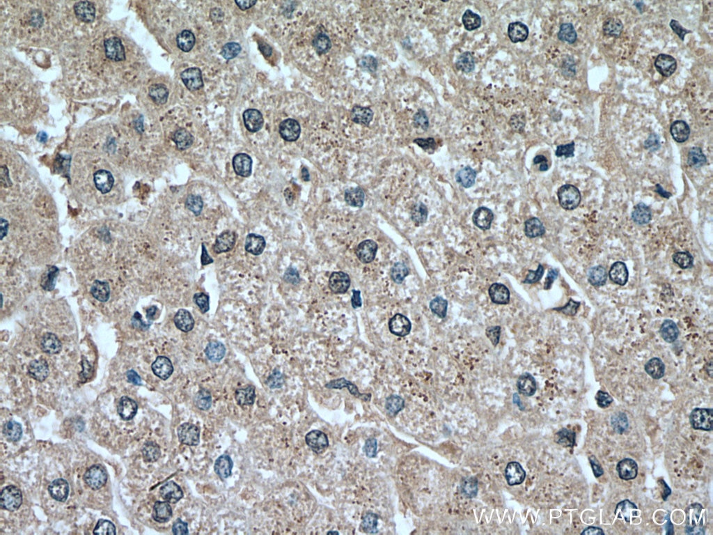 Immunohistochemistry (IHC) staining of human liver tissue using Plasminogen Polyclonal antibody (18300-1-AP)