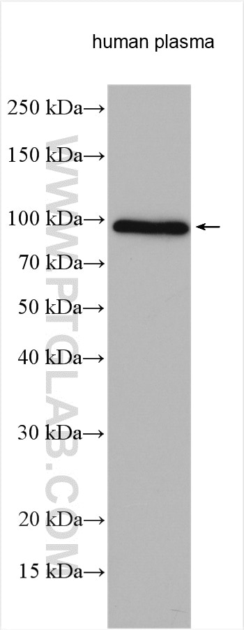 Western Blot (WB) analysis of various lysates using Plasminogen Polyclonal antibody (18300-1-AP)