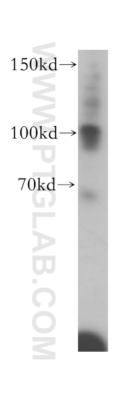 Western Blot (WB) analysis of HepG2 cells using Plasminogen Polyclonal antibody (18300-1-AP)